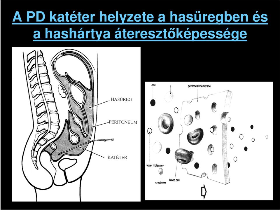 hasüregben és a