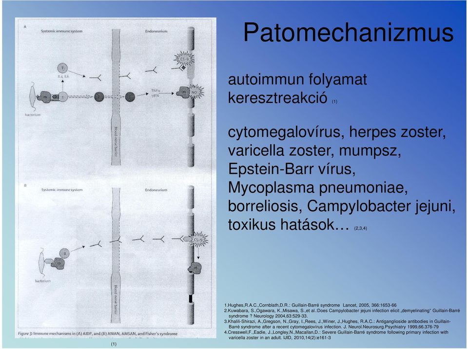 :does Campylobacter jejuni infection elicit demyelinating Guillain-Barré syndrome? Neurology 2004,63:529-33. 3.Khalili-Shirazi, A.,Gregson, N.,Gray, I.,Rees, J.,Winer, J.,Hughes, R.A.C.: Antiganglioside antibodies in Guillain- Barré syndrome after a recent cytomegalovírus infection.