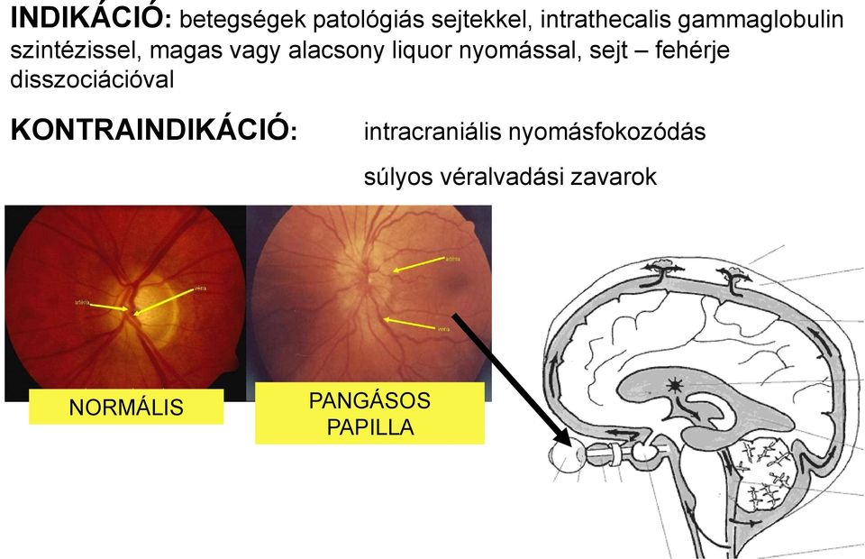 nyomással, sejt fehérje disszociációval KONTRAINDIKÁCIÓ: