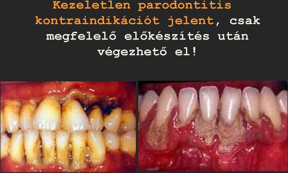 jelent, csak megfelelő