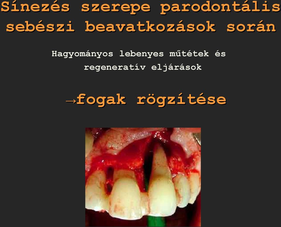 Hagyományos lebenyes műtétek és