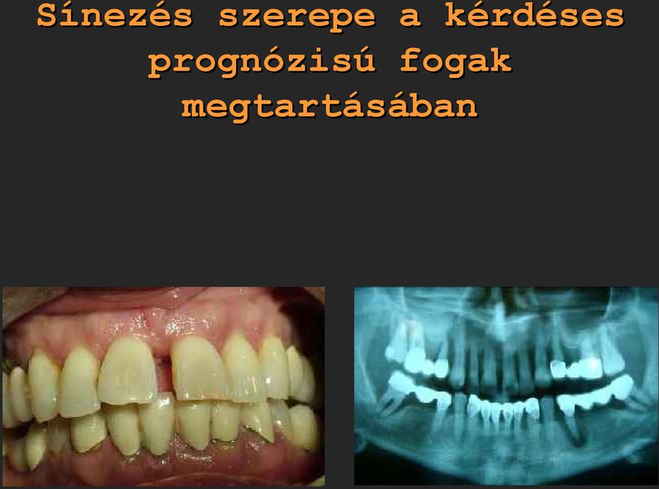 kérdéses