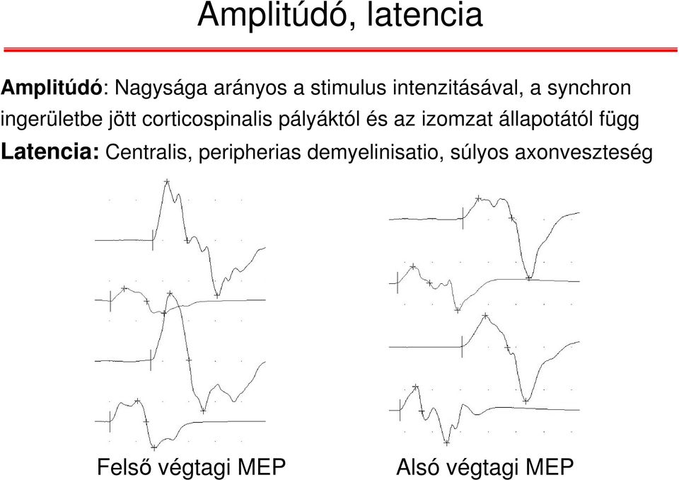 pályáktól és az izomzat állapotától függ Latencia: Centralis,