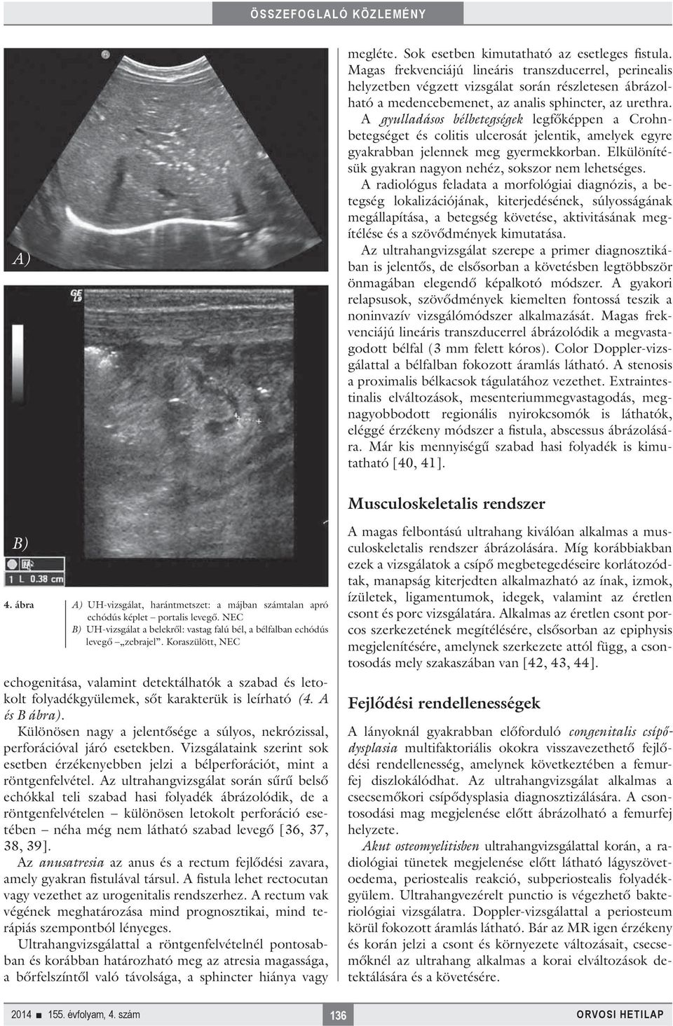 A gyulladásos bélbetegségek legfőképpen a Crohnbetegséget és colitis ulcerosát jelentik, amelyek egyre gyakrabban jelennek meg gyermekkorban.