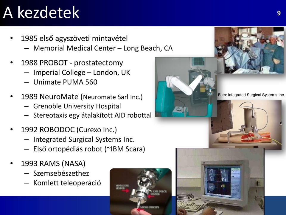 ) Grenoble University Hospital Stereotaxis egy átalakított AID robottal Fotó: Integrated Surgical Systems Inc.