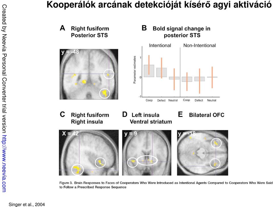 detekcióját kísérő agyi aktiváció