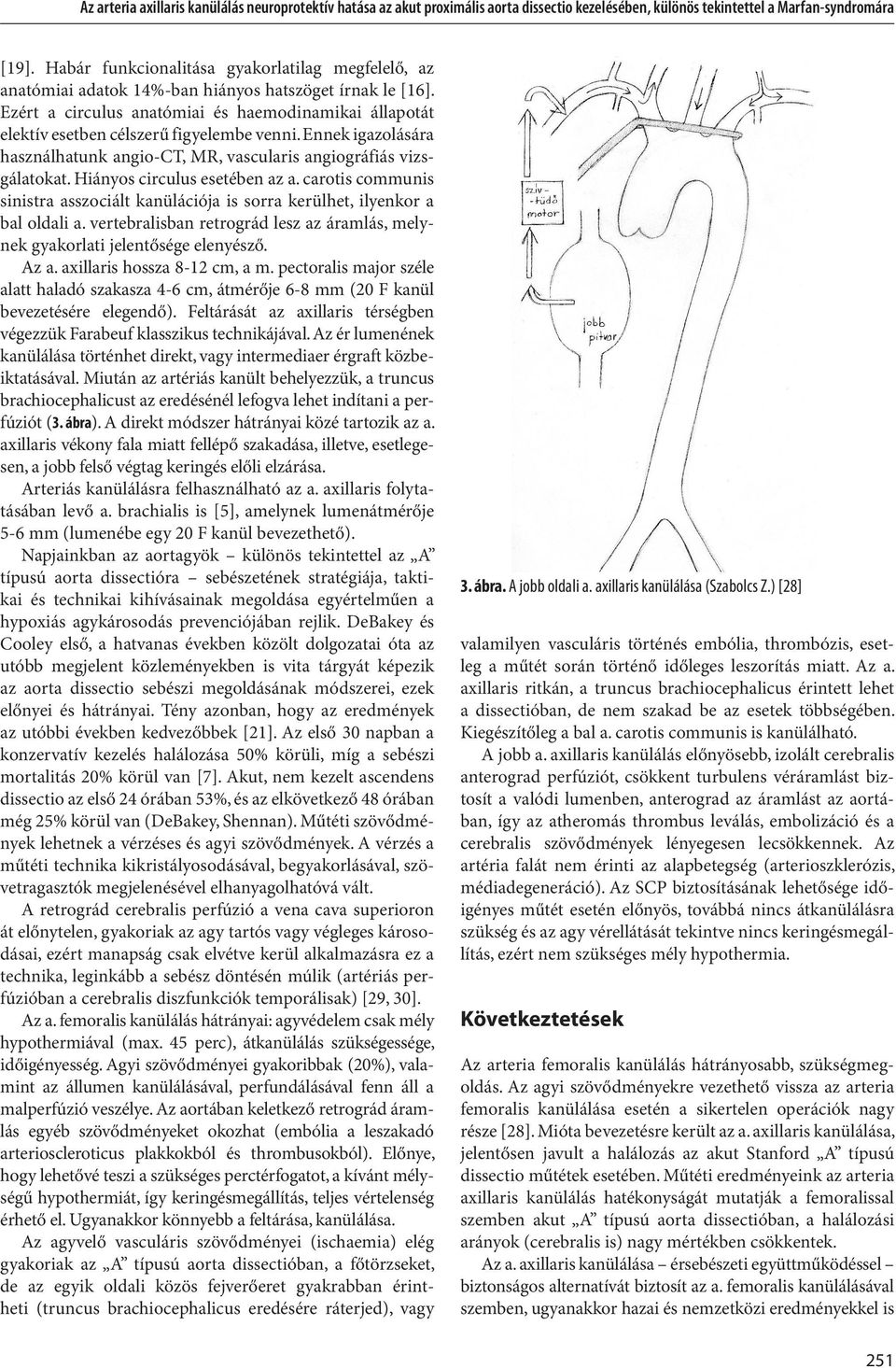 Ezért a circulus anatómiai és haemodinamikai állapotát elektív esetben célszerű figyelembe venni. Ennek igazolására használhatunk angio-ct, MR, vascularis angiográfiás vizsgálatokat.