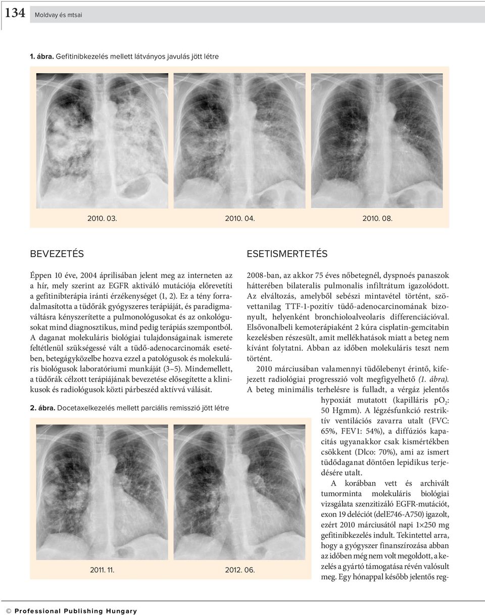 Ez a tény forradalmasította a tüdőrák gyógyszeres terápiáját, és paradigmaváltásra kényszerítette a pulmonológusokat és az onkológusokat mind diagnosztikus, mind pedig terápiás szempontból.