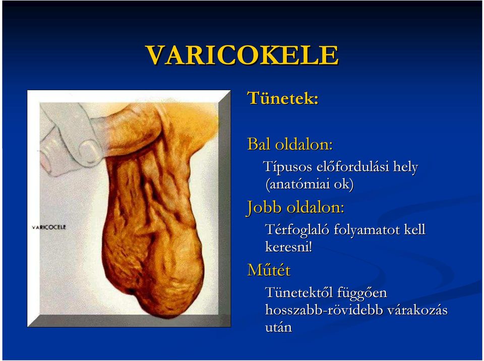 Térfoglaló folyamatot kell keresni!