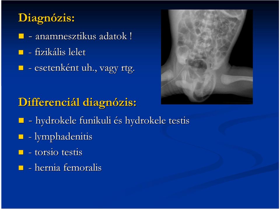 Differenciál l diagnózis: - hydrokele funikuli és