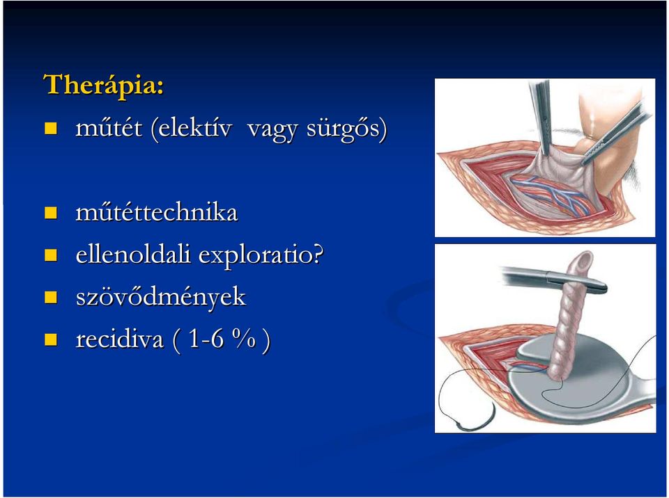 mőtéttechnikattechnika ellenoldali