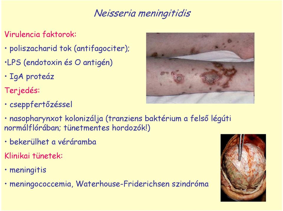 kolonizálja (tranziens baktérium a felsı légúti normálflórában; tünetmentes hordozók!