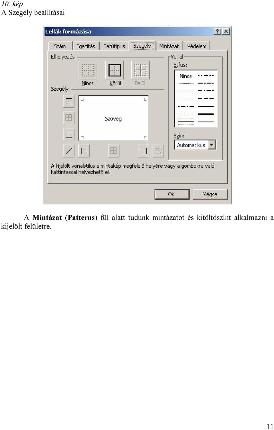 tudunk mintázatot és