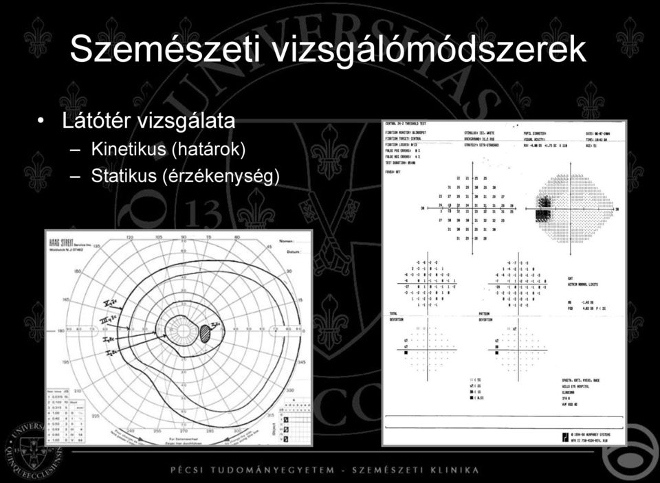 Látótér vizsgálata