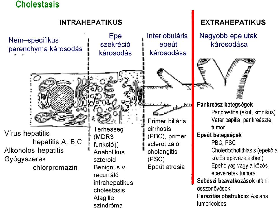 recurráló intrahepatikus cholestasis Alagille szindróma Primer biliáris cirrhosis (PBC), primer sclerotizáló cholangitis (PSC) Epeút atresia Pankreász betegségek Pancreatitis (akut,