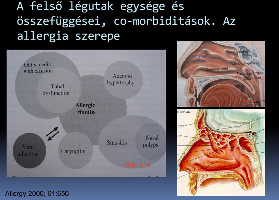 co-morbiditások.