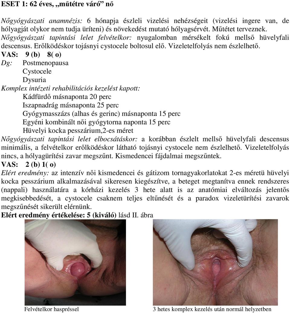 VAS: 9 (b) 8( o) Dg: Postmenopausa Cystocele Dysuria Komplex intézeti rehabilitációs kezelést kapott: Kádfürdő másnaponta 20 perc Iszapnadrág másnaponta 25 perc Gyógymasszázs (alhas és gerinc)