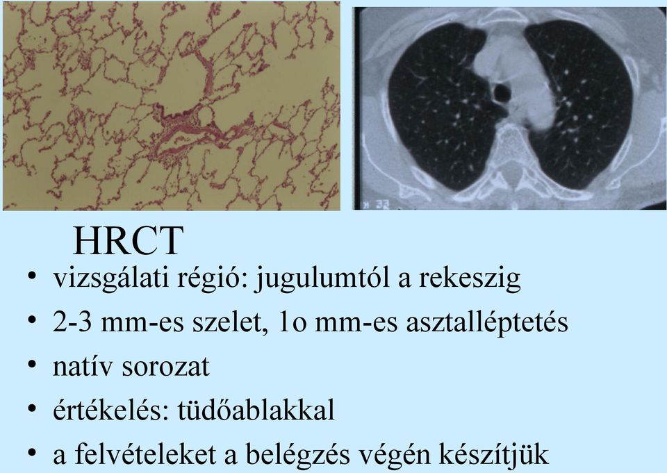 asztalléptetés natív sorozat értékelés: