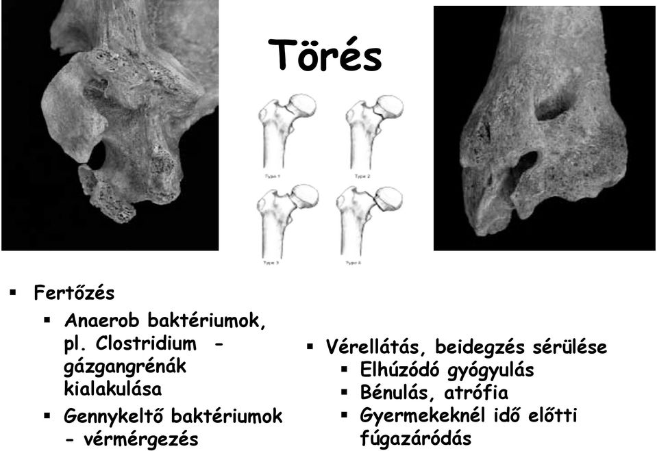 baktériumok - vérmérgezés Vérellátás, beidegzés