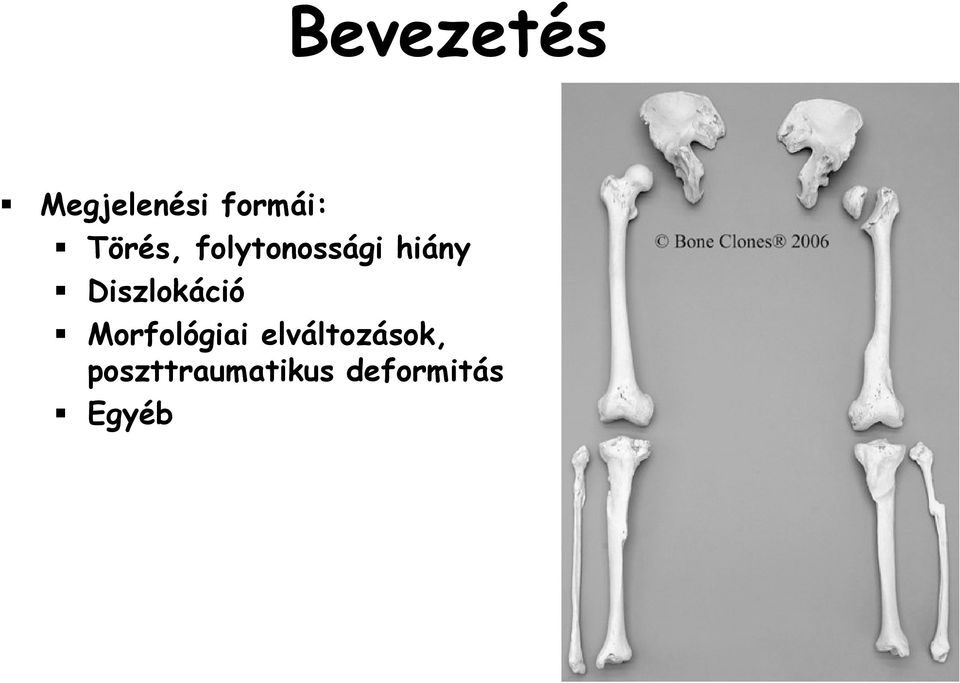 Diszlokáció Morfológiai