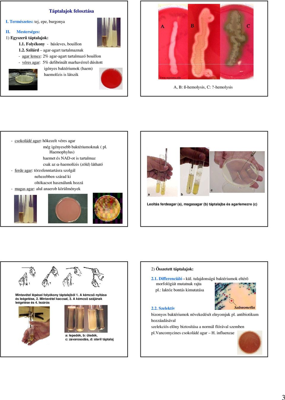 edu A, B: ß-hemolysis, C:?-hemolysis - csokoládé agar: hõkezelt véres agar még igényesebb baktériumoknak ( pl.