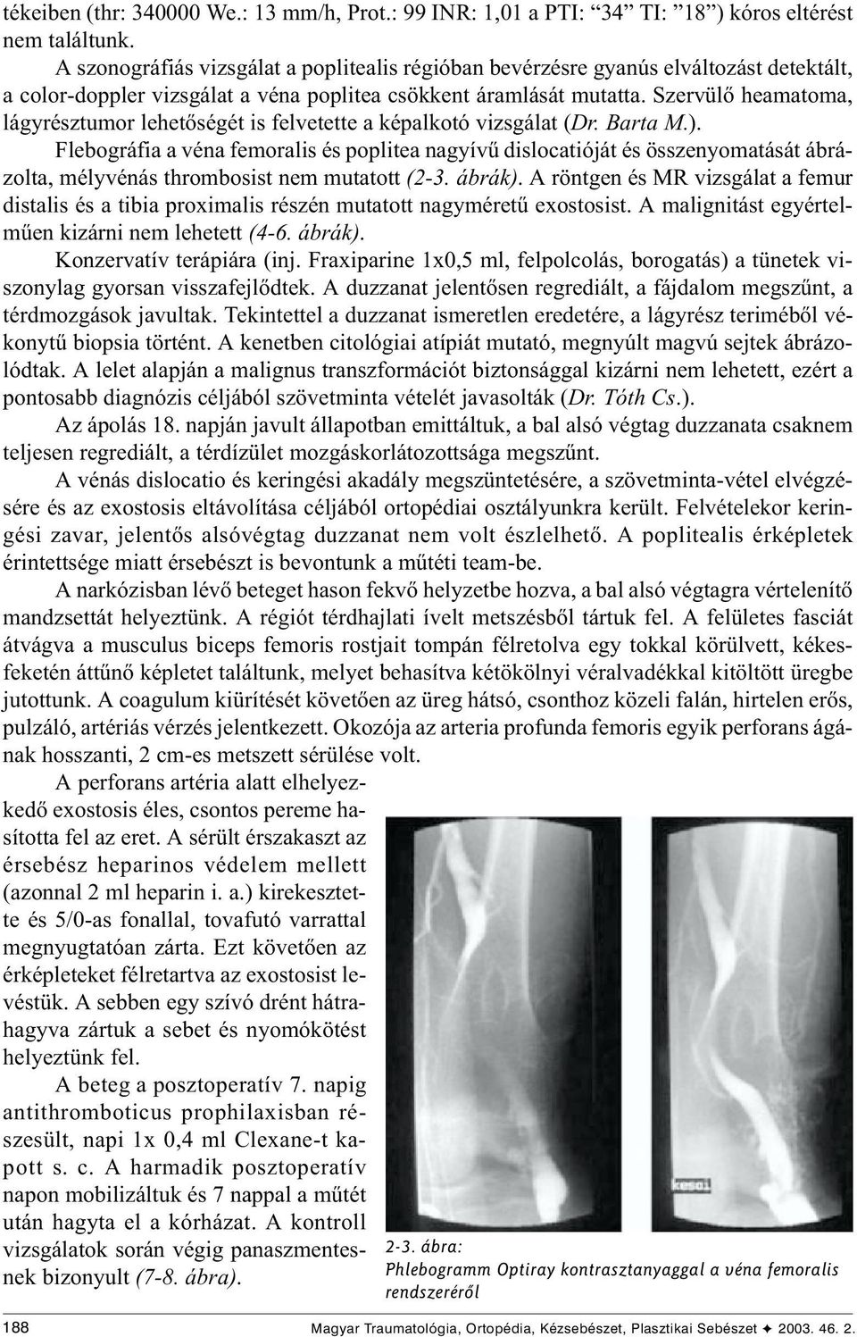 Szervülõ heamatoma, lágyrésztumor lehetõségét is felvetette a képalkotó vizsgálat (Dr. Barta M.).