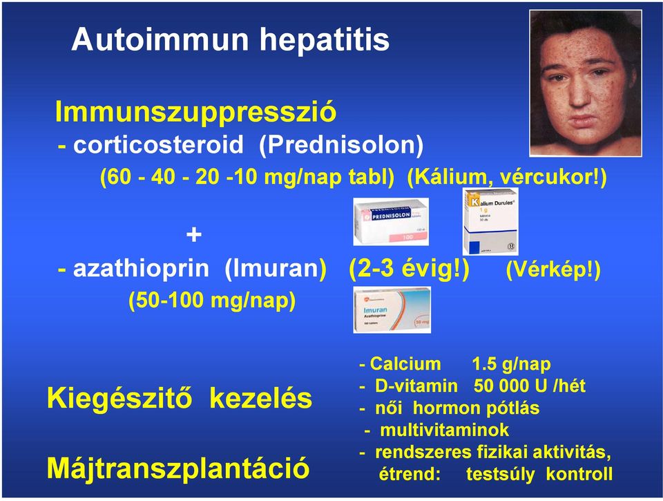 ) (50-100 mg/nap) Kiegészitő kezelés Májtranszplantáció - Calcium 1.