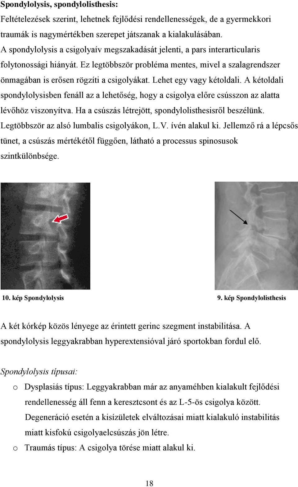 Lehet egy vagy kétoldali. A kétoldali spondylolysisben fenáll az a lehetőség, hogy a csigolya előre csússzon az alatta lévőhöz viszonyítva. Ha a csúszás létrejött, spondylolisthesisről beszélünk.