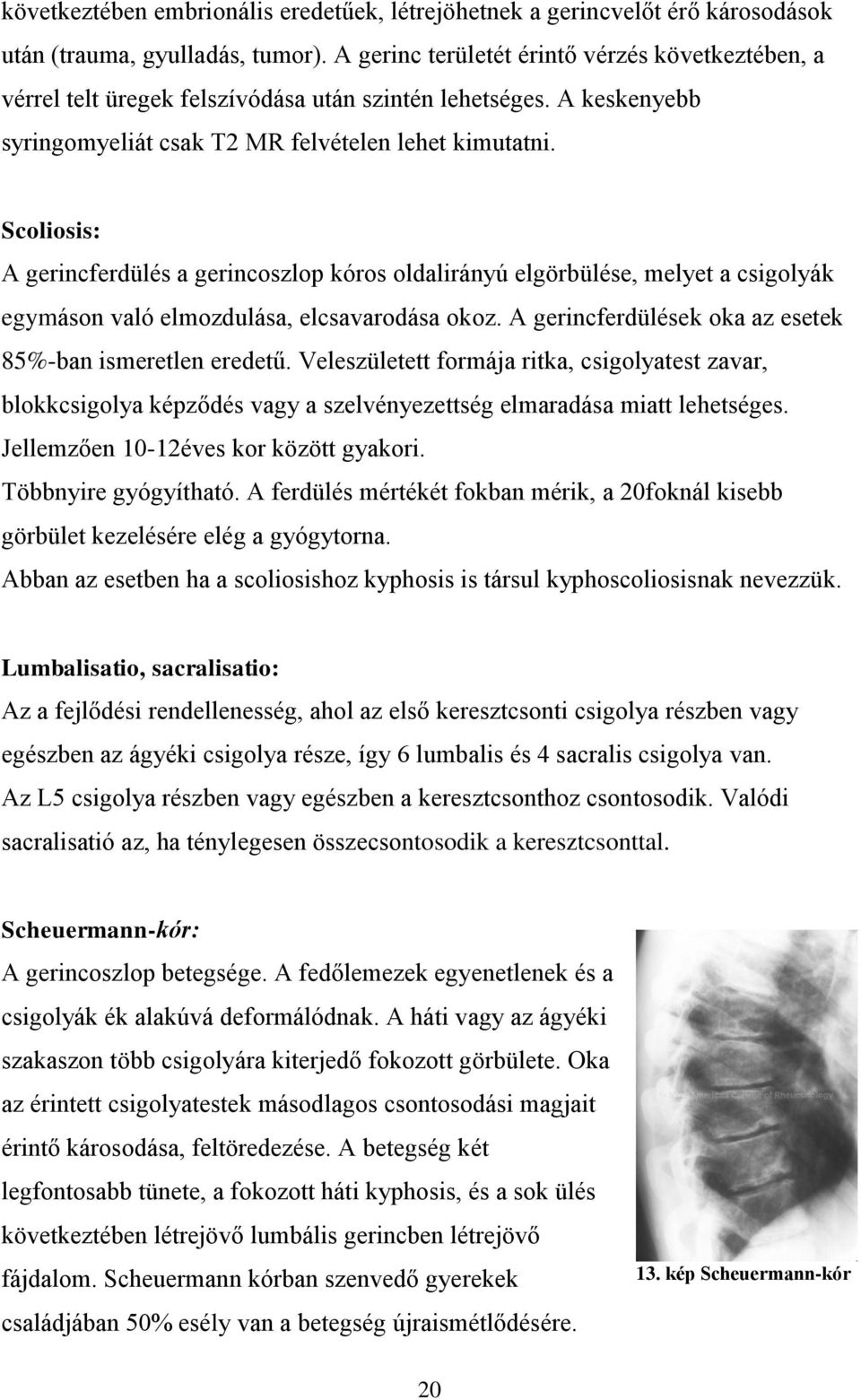 Scoliosis: A gerincferdülés a gerincoszlop kóros oldalirányú elgörbülése, melyet a csigolyák egymáson való elmozdulása, elcsavarodása okoz. A gerincferdülések oka az esetek 85%-ban ismeretlen eredetű.