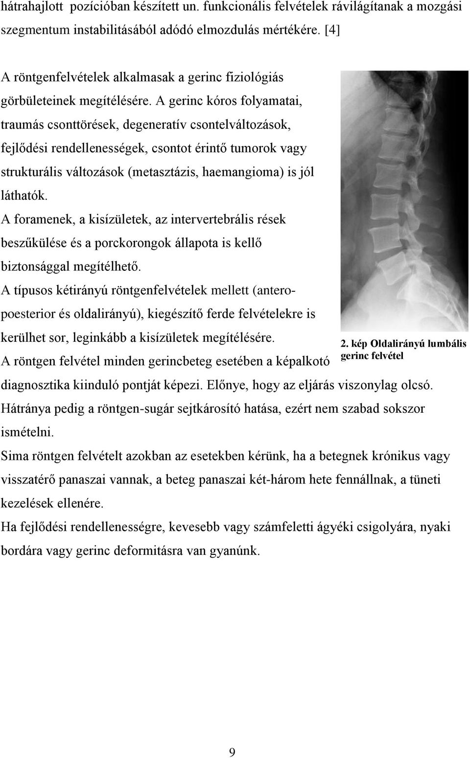 A gerinc kóros folyamatai, traumás csonttörések, degeneratív csontelváltozások, fejlődési rendellenességek, csontot érintő tumorok vagy strukturális változások (metasztázis, haemangioma) is jól