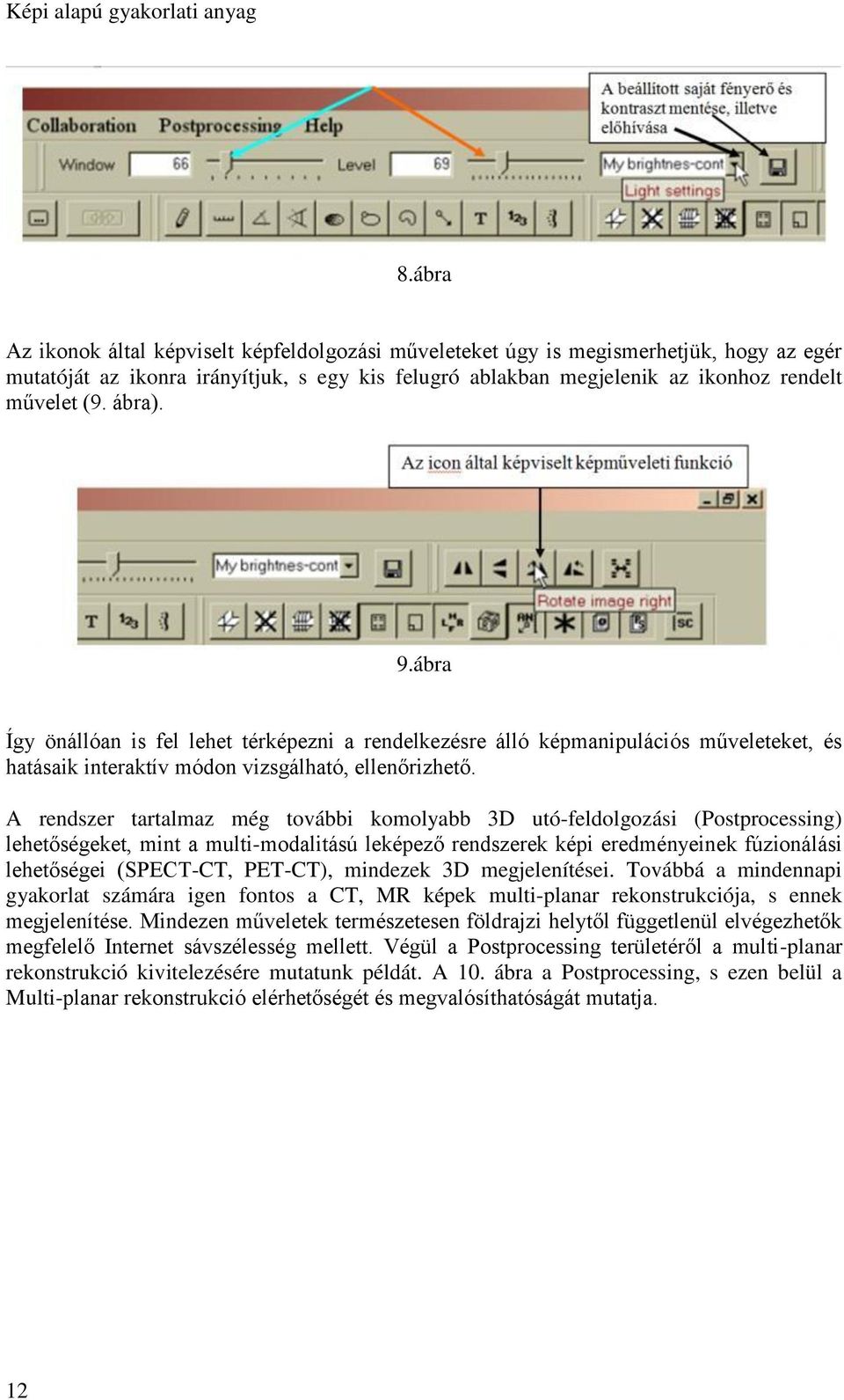 A rendszer tartalmaz még további komolyabb 3D utó-feldolgozási (Postprocessing) lehetőségeket, mint a multi-modalitású leképező rendszerek képi eredményeinek fúzionálási lehetőségei (SPECT-CT,