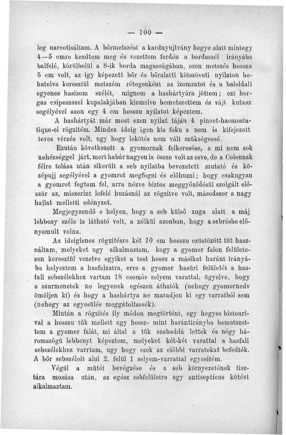 képezett bőr és bőralatti kötszöveti nyilaton behatolva keresztül metszem rétegenként az izomzatot és a baloldali egyenes hasizom szélét, mignem a hashártyára jöttem; ezt horgas csipeszszel