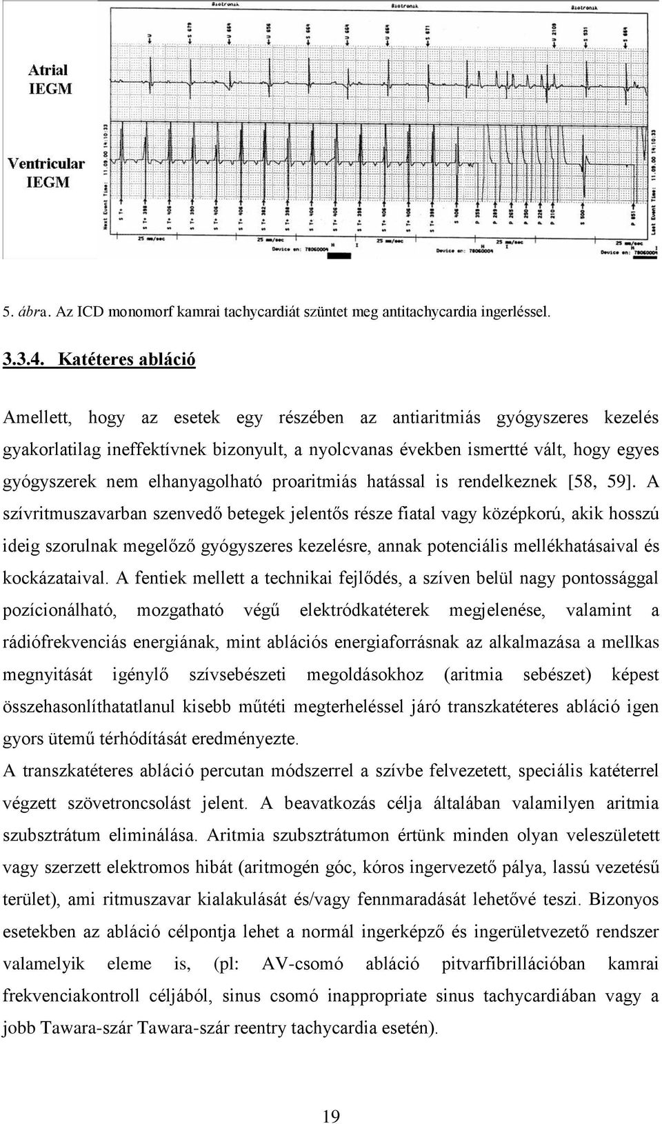 elhanyagolható proaritmiás hatással is rendelkeznek [58, 59].