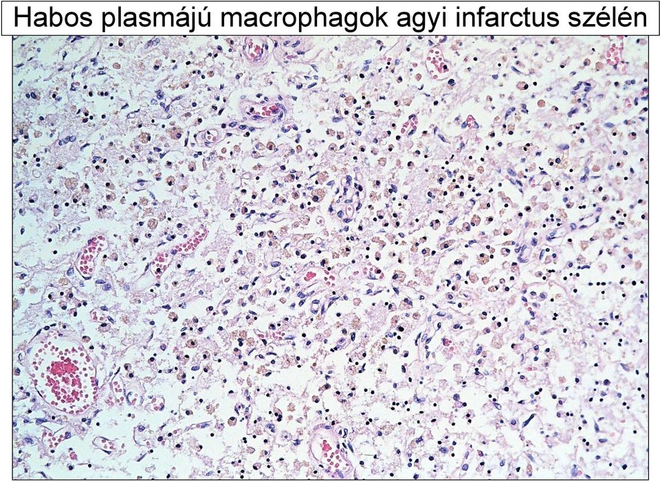 macrophagok