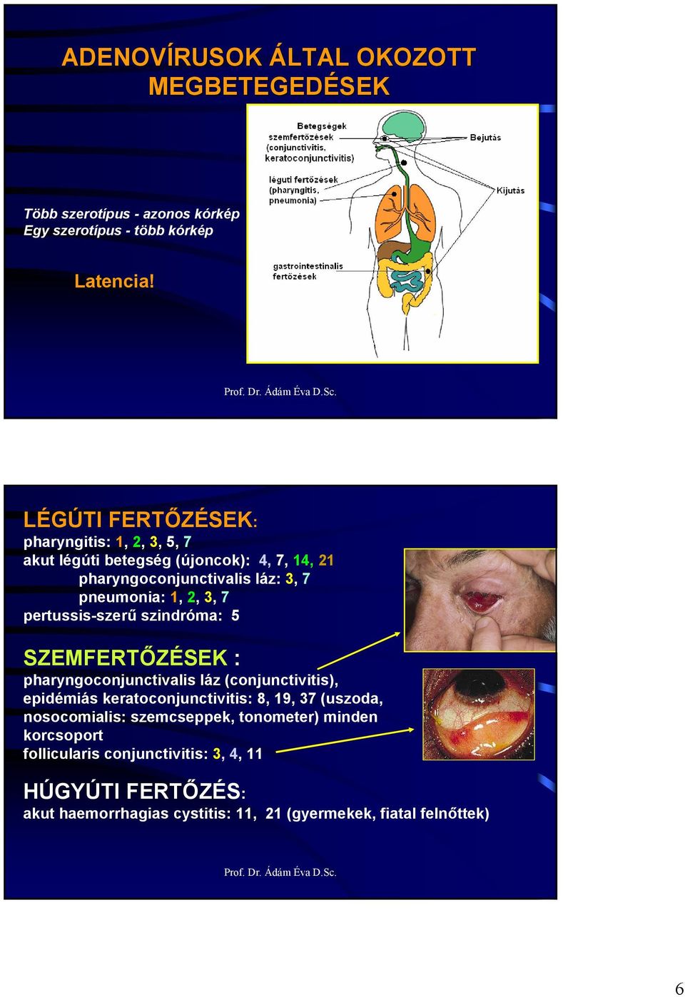 7 pertussis-szerő szindróma: 5 SZEMFERTİZÉSEK : pharyngoconjunctivalis láz (conjunctivitis), epidémiás keratoconjunctivitis: 8, 19, 37 (uszoda,