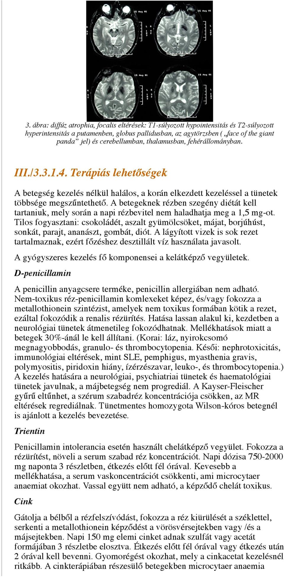 A betegeknek rézben szegény diétát kell tartaniuk, mely során a napi rézbevitel nem haladhatja meg a 1,5 mg-ot.