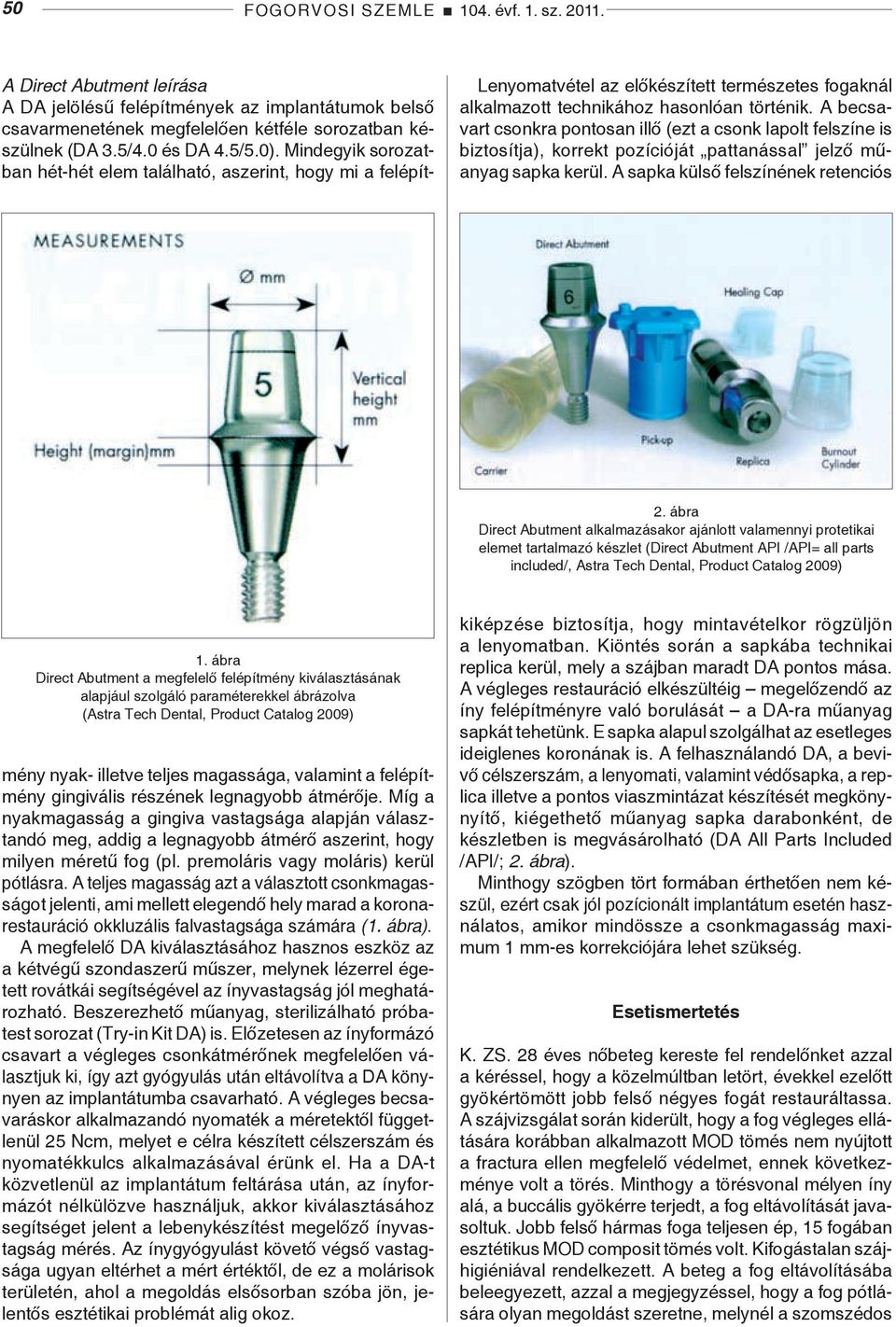 ábra Direct Abutment alkalmazásakor ajánlott valamennyi protetikai elemet tartalmazó készlet (Direct Abutment API /API= all parts included/, Astra Tech Dental, Product Catalog 2009) 1.