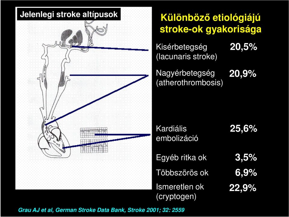 (atherothrombosis) 20,5% 20,9% Kardiális embolizáció Egyéb ritka ok Többszörös ok
