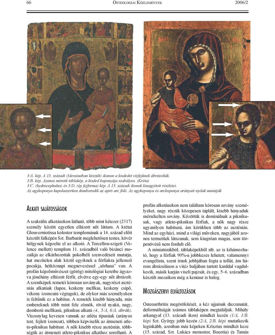 Az agykoponya és arckoponya arányait nyilak mutatják ALKATI SAJÁTOSSÁGOK A szakrális alkotásokon látható, több mint kétezer (2317) személy között egyetlen elhízott nõt láttam.