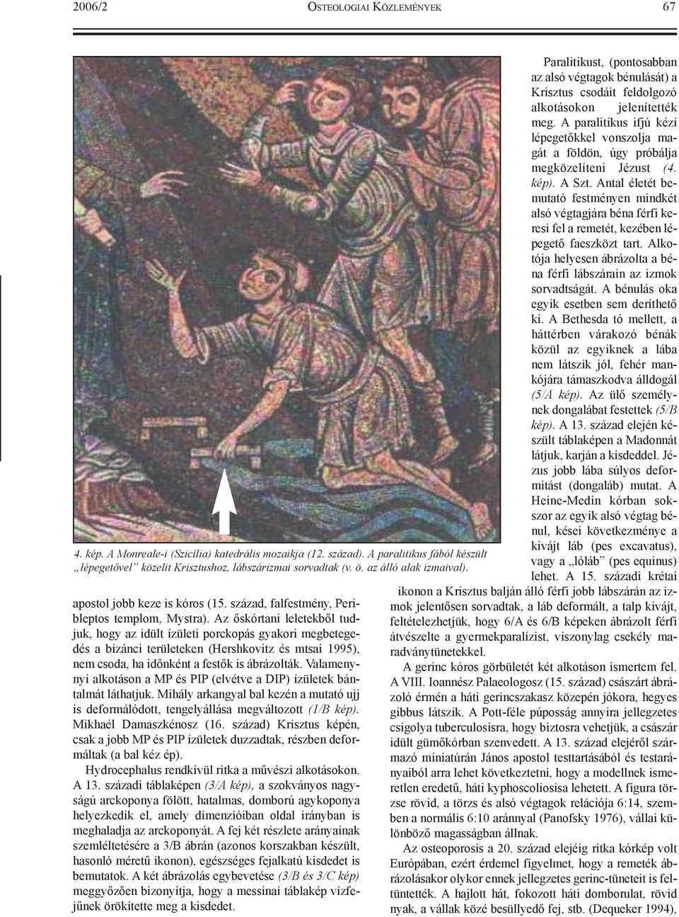 Az õskórtani leletekbõl tudjuk, hogy az idült ízületi porckopás gyakori megbetegedés a bizánci területeken (Hershkovitz és mtsai 1995), nem csoda, ha idõnként a festõk is ábrázolták.