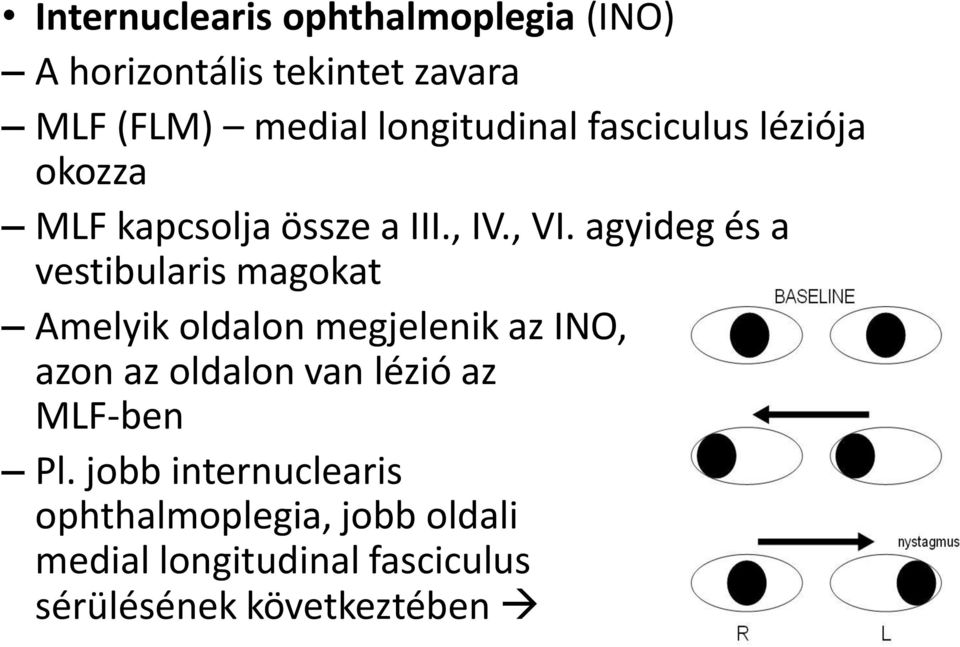 agyideg és a vestibularis magokat Amelyik oldalon megjelenik az INO, azon az oldalon van