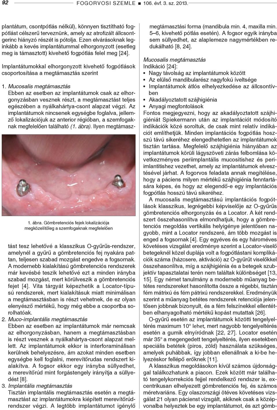 Implantátumokkal elhorgonyzott kivehető fogpótlások csoportosítása a megtámasztás szerint 1.