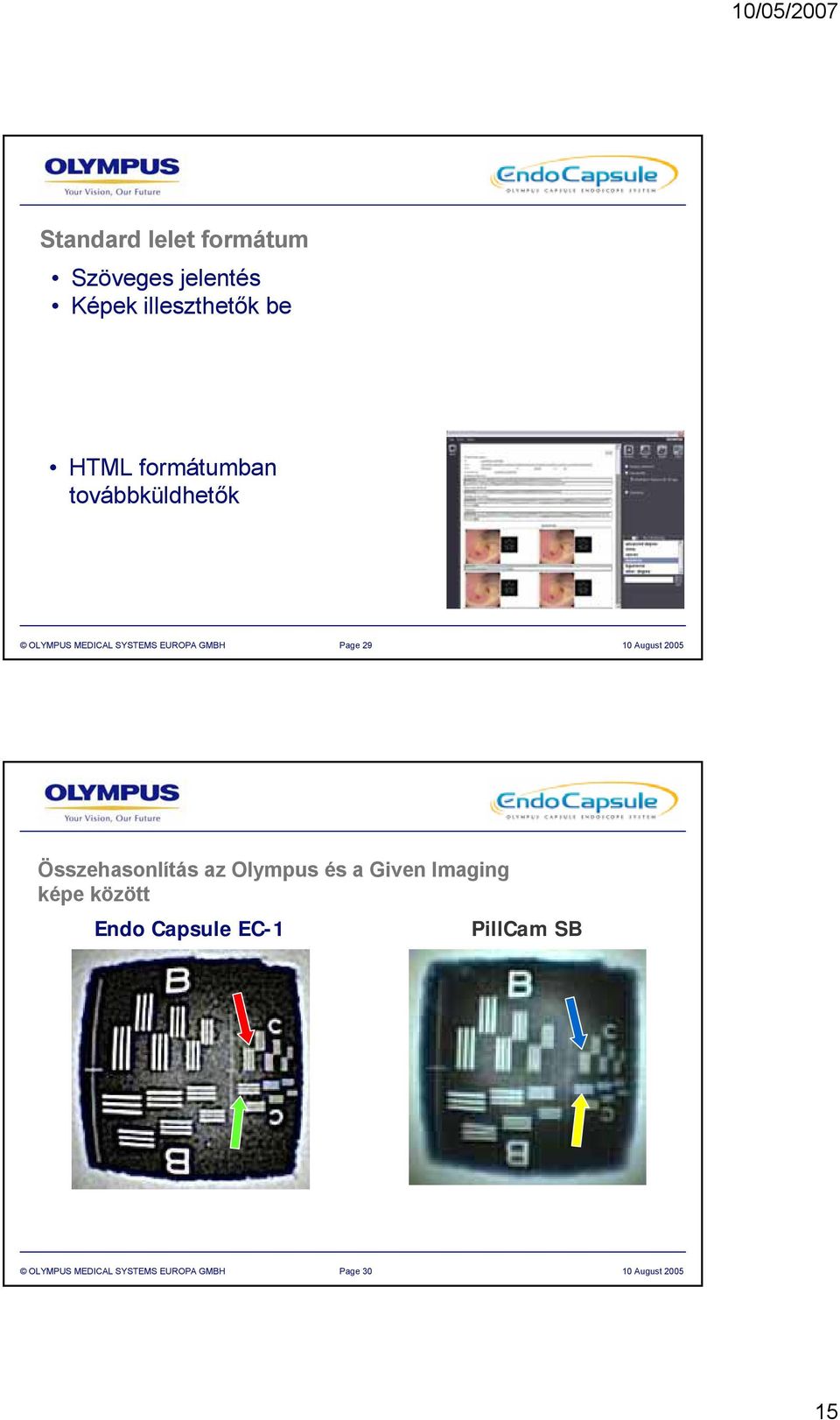 August 2005 Összehasonlítás az Olympus és a Given Imaging képe között Endo