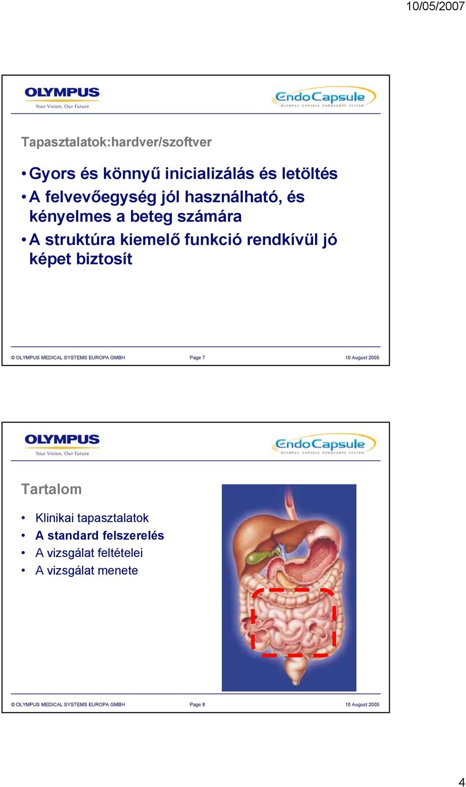 OLYMPUS MEDICAL SYSTEMS EUROPA GMBH Page 7 0 August 2005 Tartalom Klinikai tapasztalatok A standard