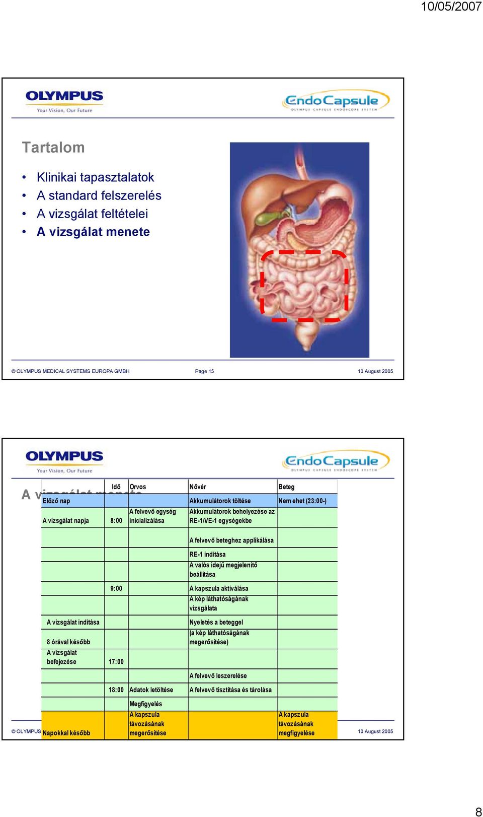 valós idejű megjelenítő beállítása 9:00 A kapszula aktiválása A kép láthatóságának vizsgálata A vizsgálat indítása Nyeletés a beteggel (a kép láthatóságának 8 órával később megerősítése) A vizsgálat