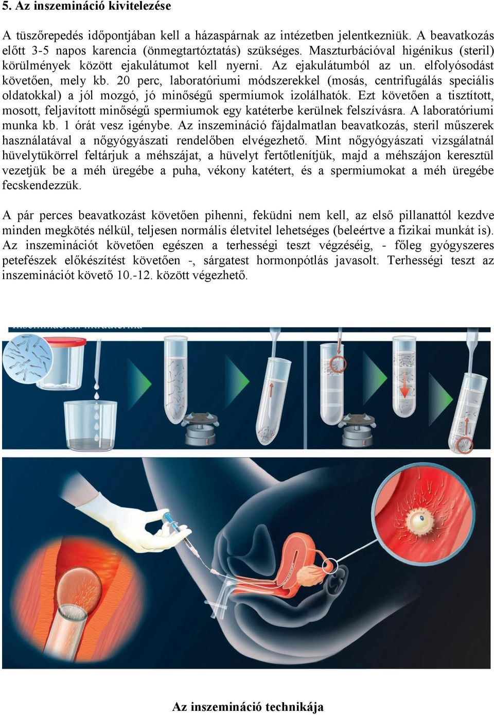 20 perc, laboratóriumi módszerekkel (mosás, centrifugálás speciális oldatokkal) a jól mozgó, jó minőségű spermiumok izolálhatók.