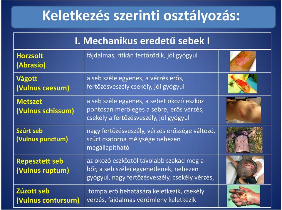 pontosan merőleges a sebre, erős vérzés, csekély a fertőzésveszély, jól gyógyul Szúrt seb (Vulnus punctum) Repesztett seb (Vulnus ruptum) Zúzott seb (Vulnus contursum) nagy fertőzésveszély,