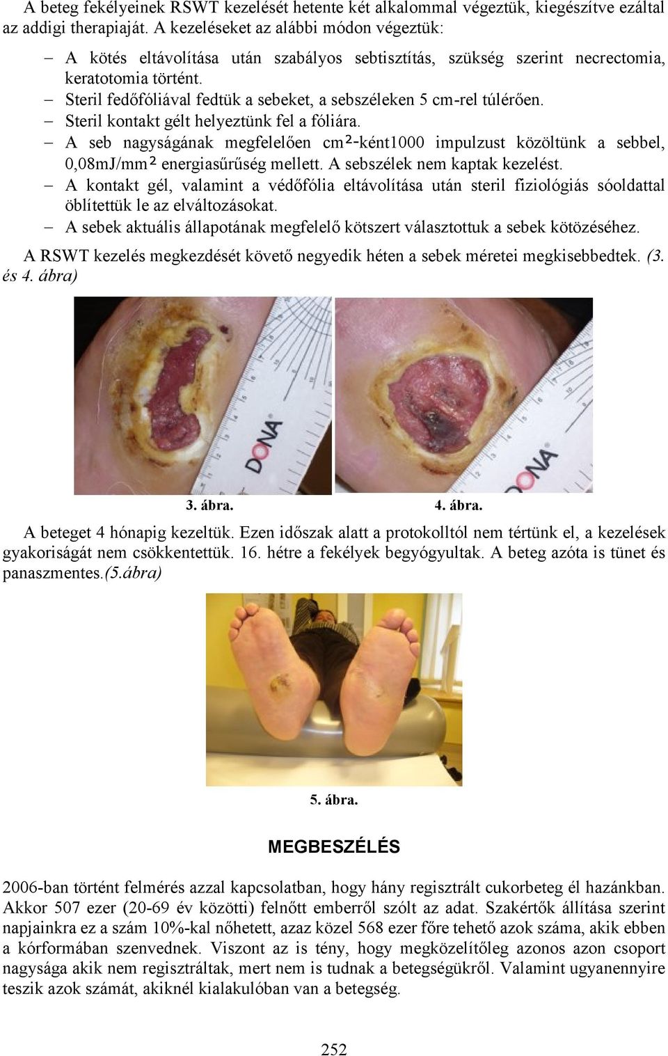 Steril fedőfóliával fedtük a sebeket, a sebszéleken 5 cm-rel túlérően. Steril kontakt gélt helyeztünk fel a fóliára.