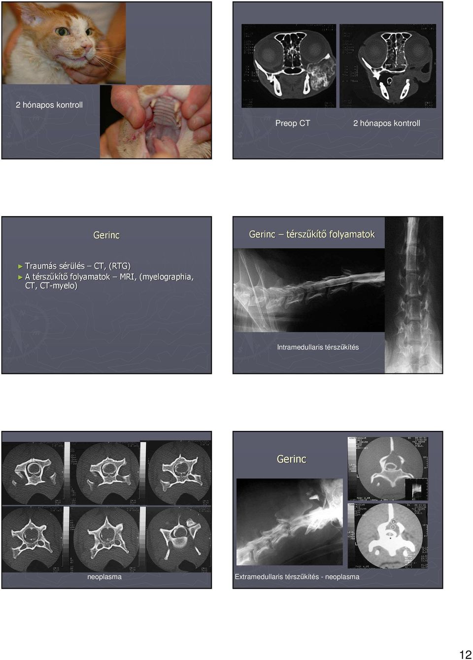 MRI, (myelographia (myelographia,, CT, CTCT-myelo) myelo) A