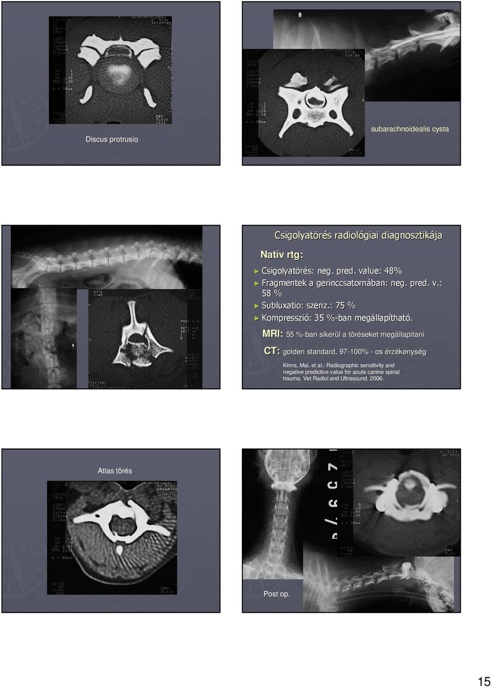 MRI: 55 % CT: golden standard, 97-100% - os érzékenység CT: 55 %-ban sikerül a töréseket megállapítani Kinns, Mai, et al.